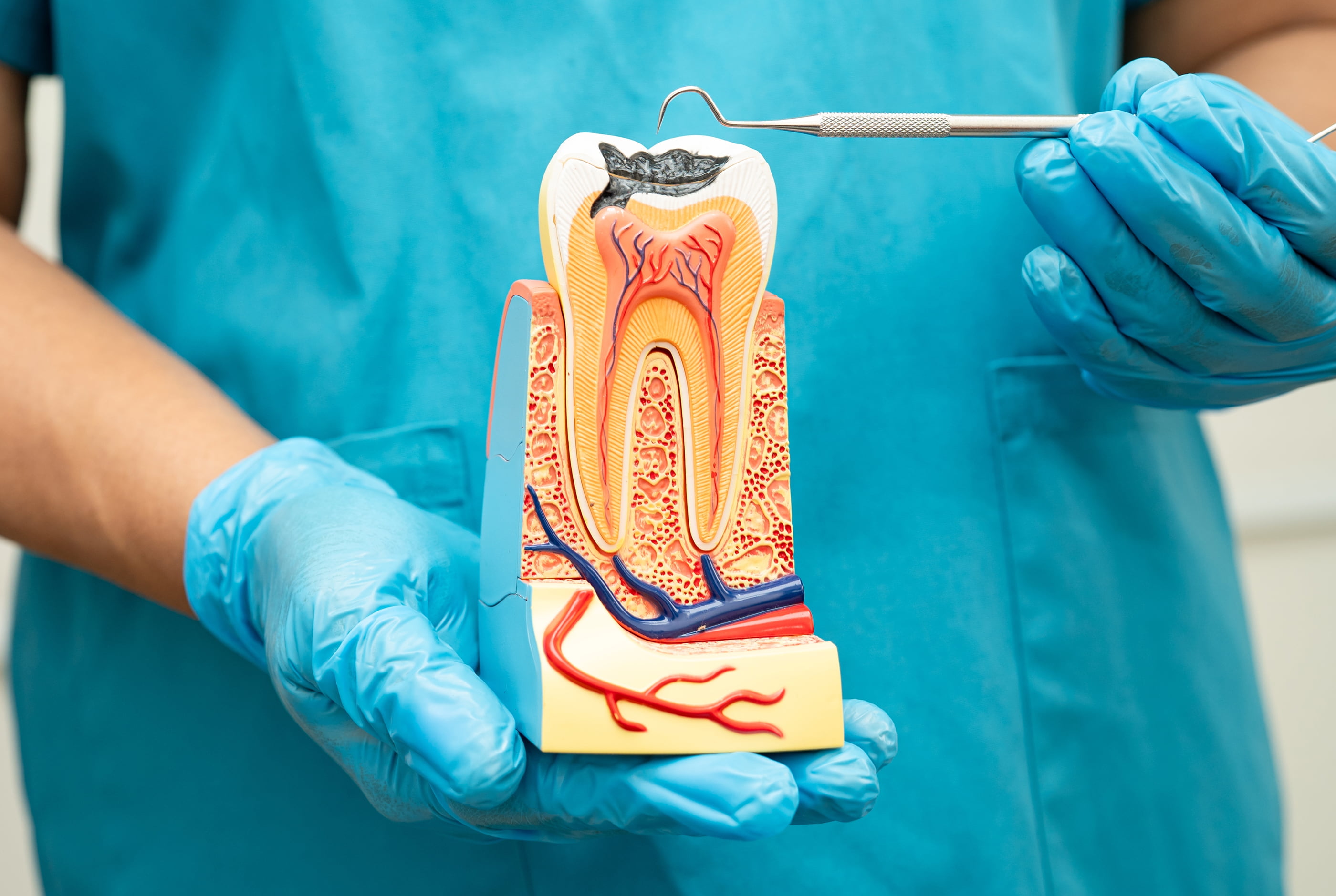 Pain-free root canal treatment at Pure Arts