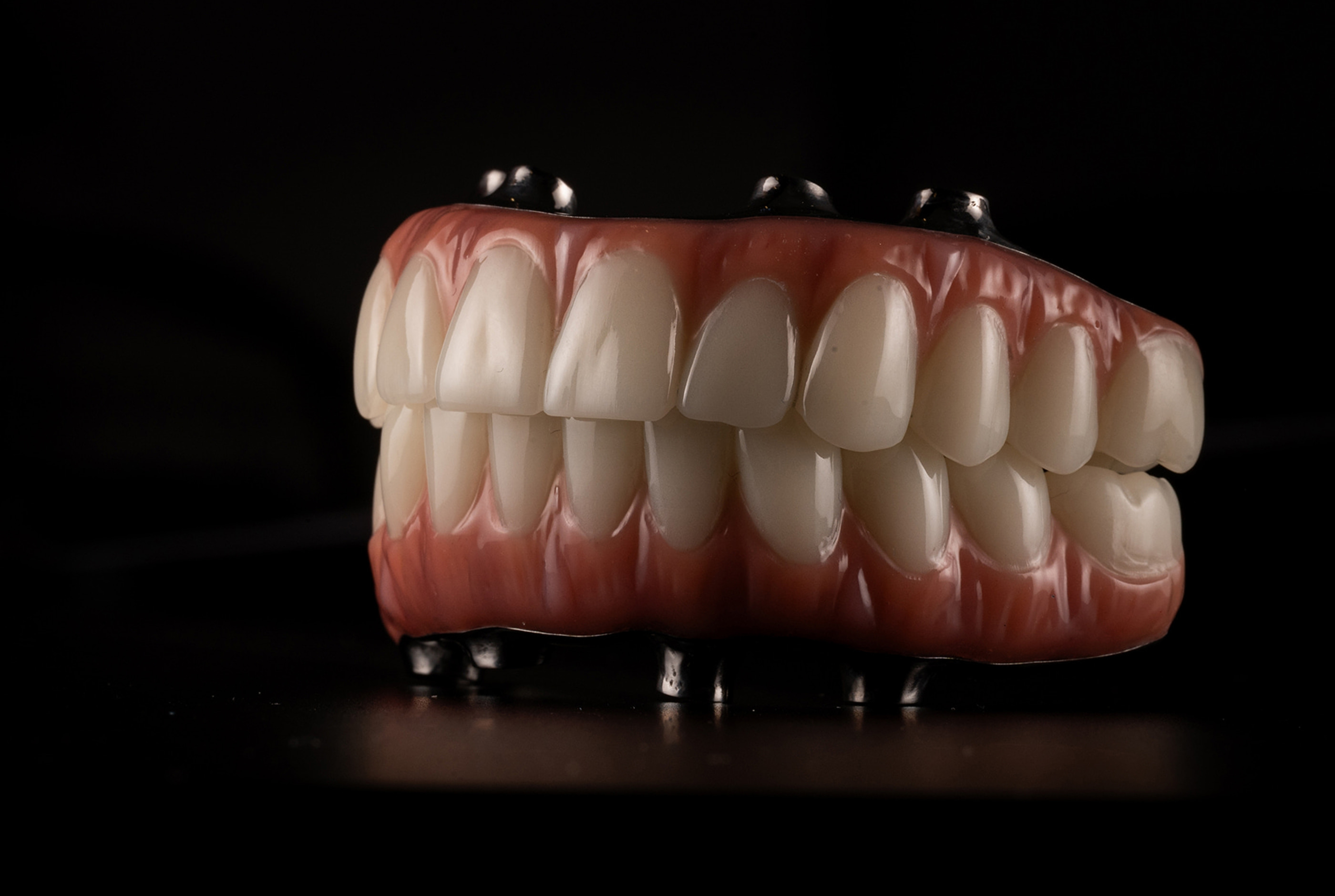 Full mouth reconstruction evaluation at Pure Arts