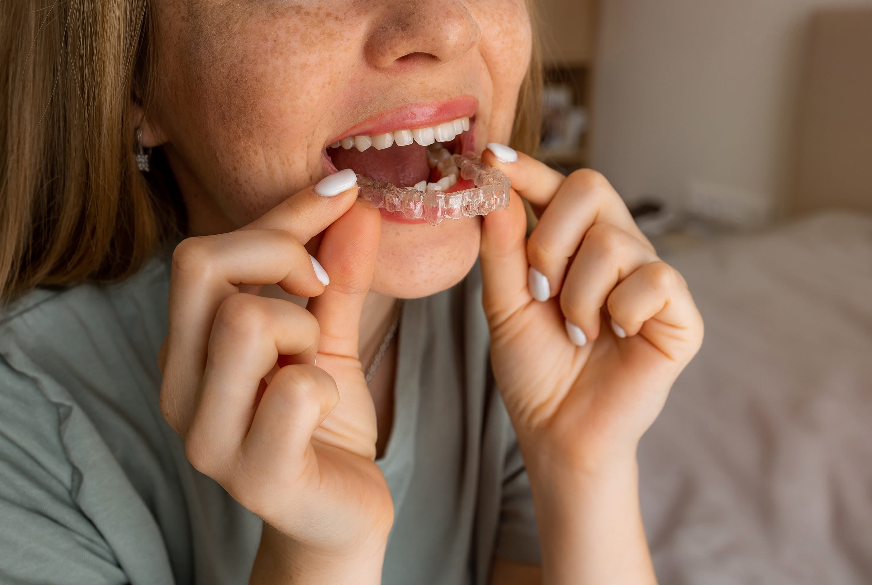 Invisalign vs braces consultation at Pure Arts