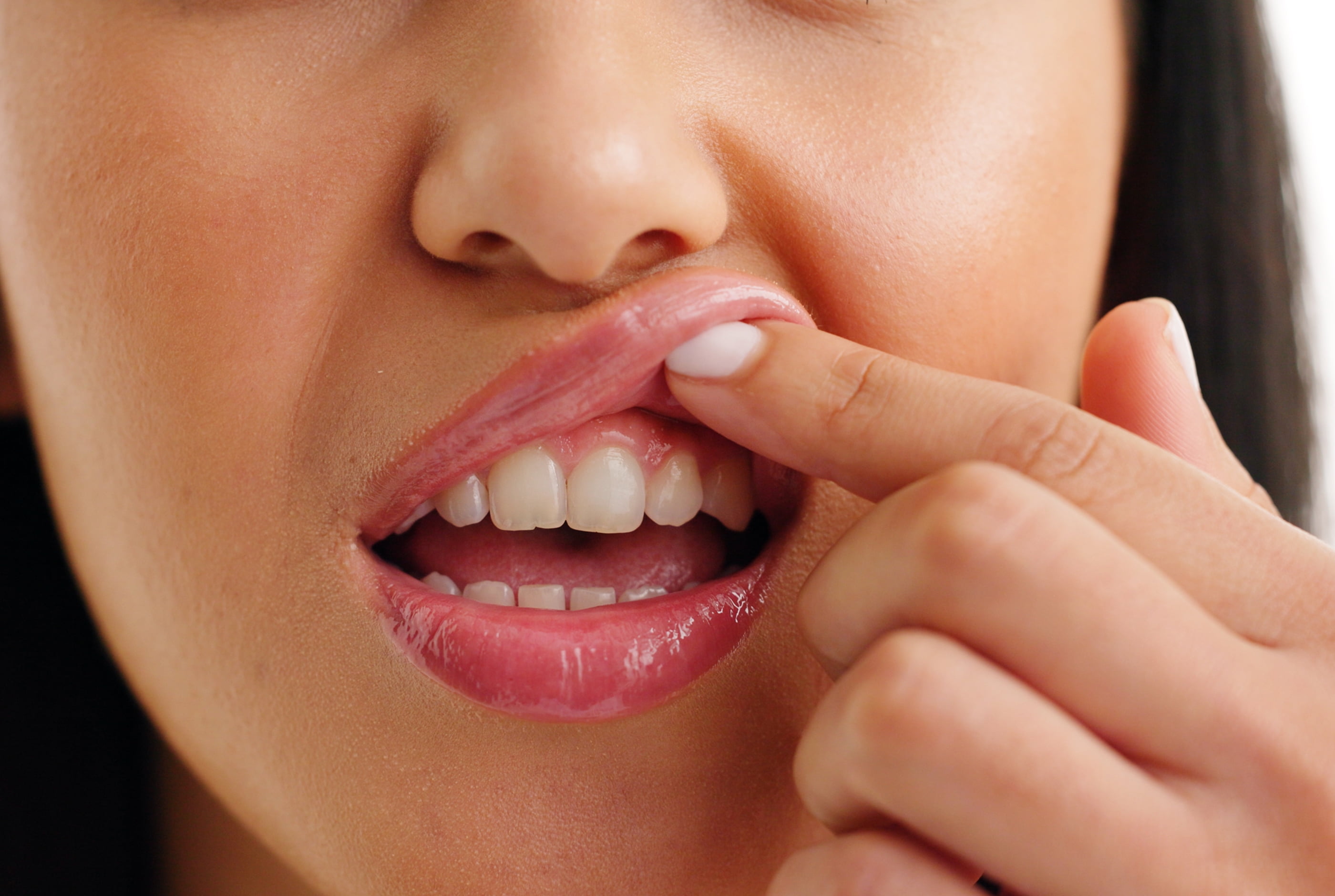 LANAP laser gum treatment at Pure Arts Dental Care