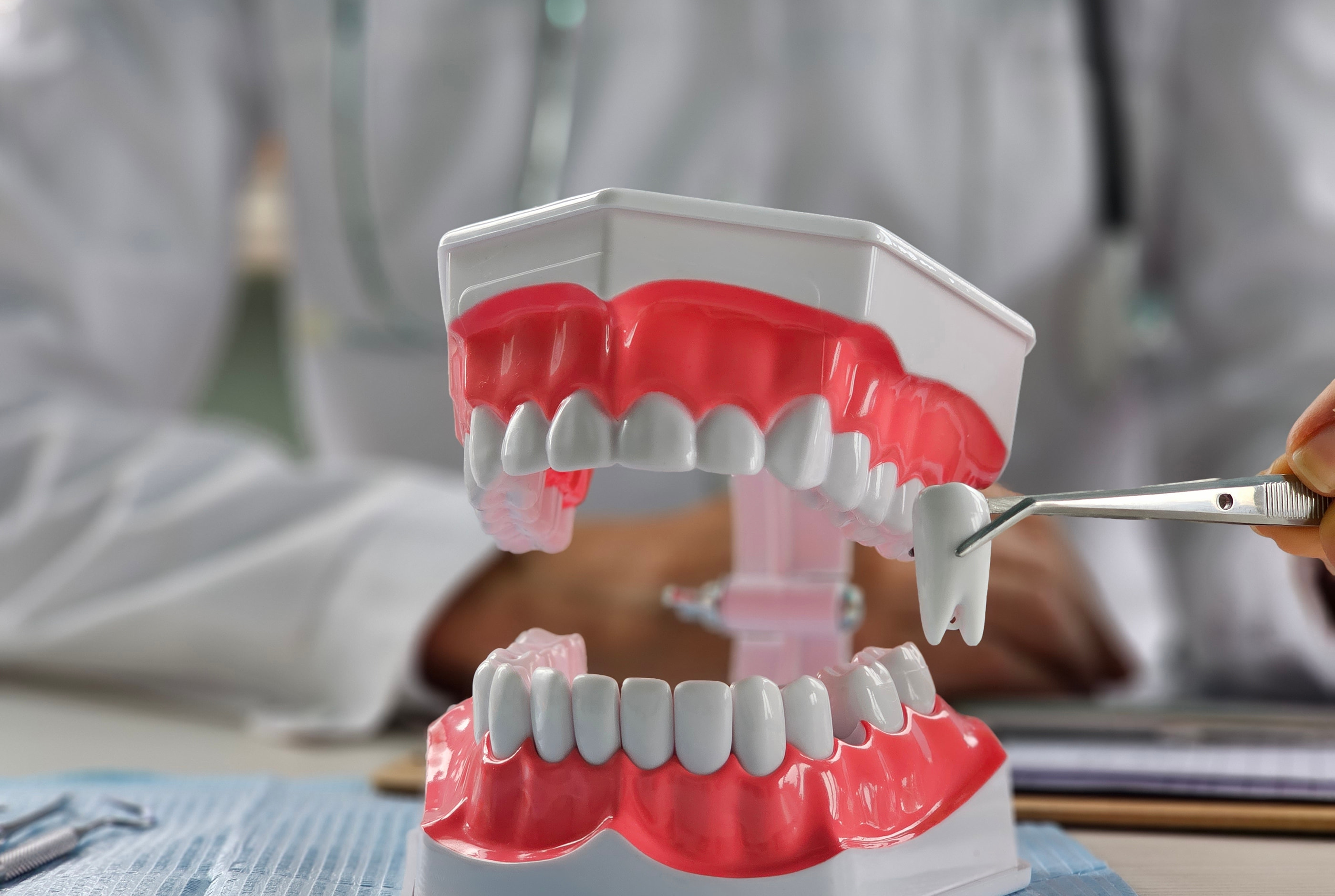 Wisdom teeth removal at Pure Arts Dental Care